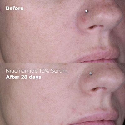 Skin Republic Niacinamide 10% + Zinc 1% Serum 30ml